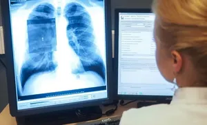 Новый рентген-аппарат получил противотуберкулезный диспансер Салехарда