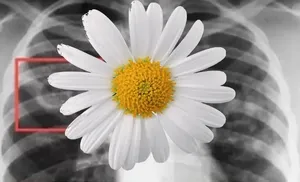 «Белая ромашка» стартовала в округе