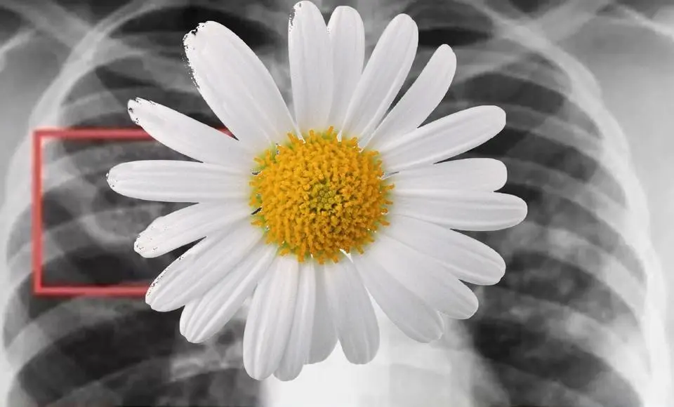 «Белая ромашка» стартовала в округе